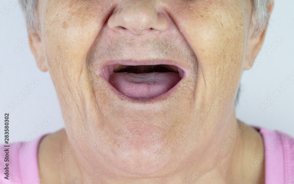 Toothless mouth. An elderly woman with no teeth. Old Granny with her