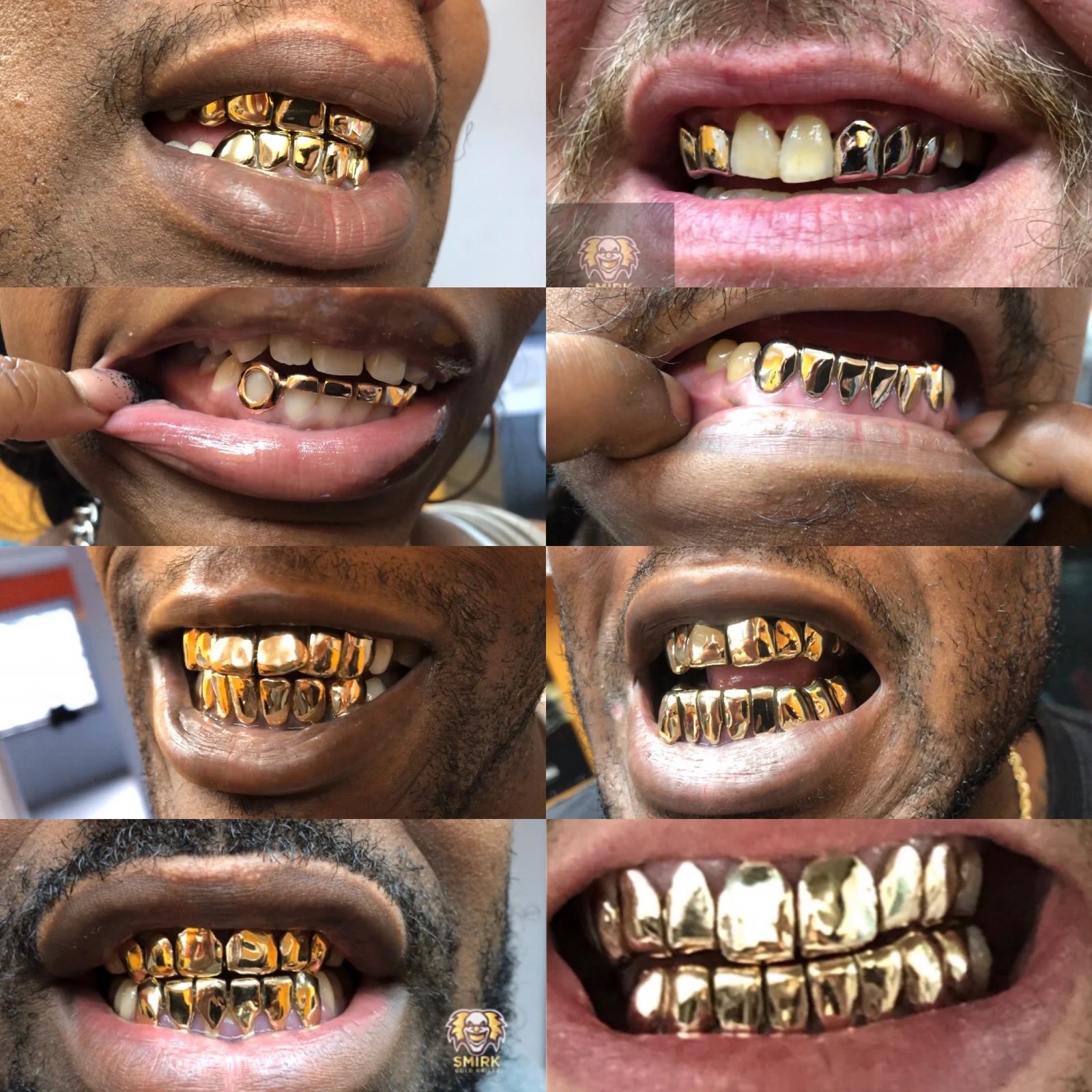 10K GOLD GRILLZ SmirkGoldGrillz