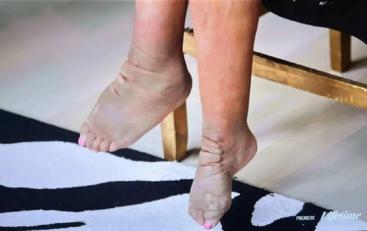 What Happened To Wendy Williams Feet? Surgery And Health