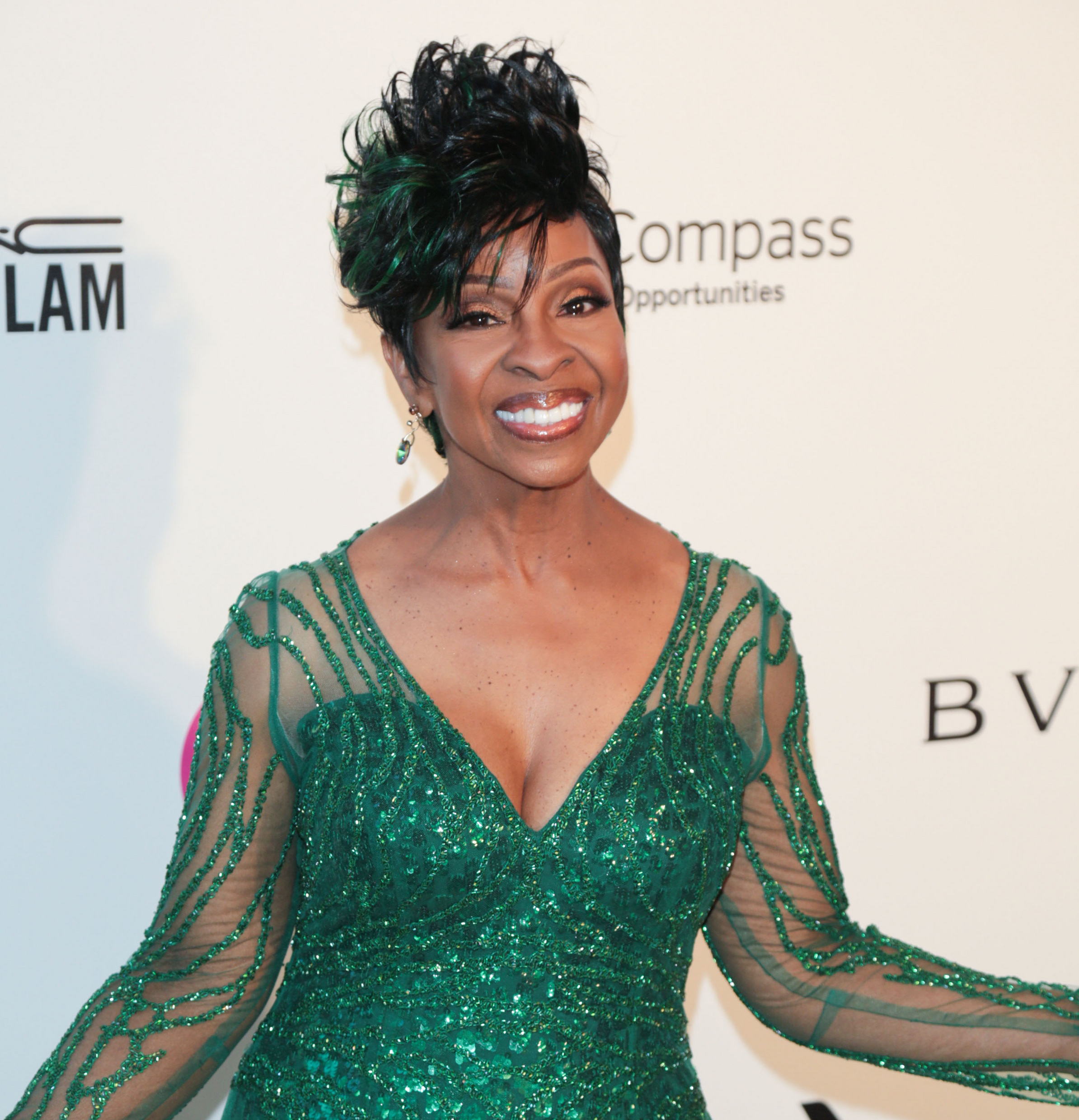 Gladys Knight Provides The Receipts On Plastic Surgery Rumors Black