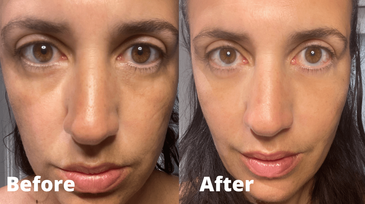 Is the Peter Thomas Roth Instant FirmX Eye Cream really worth the hype