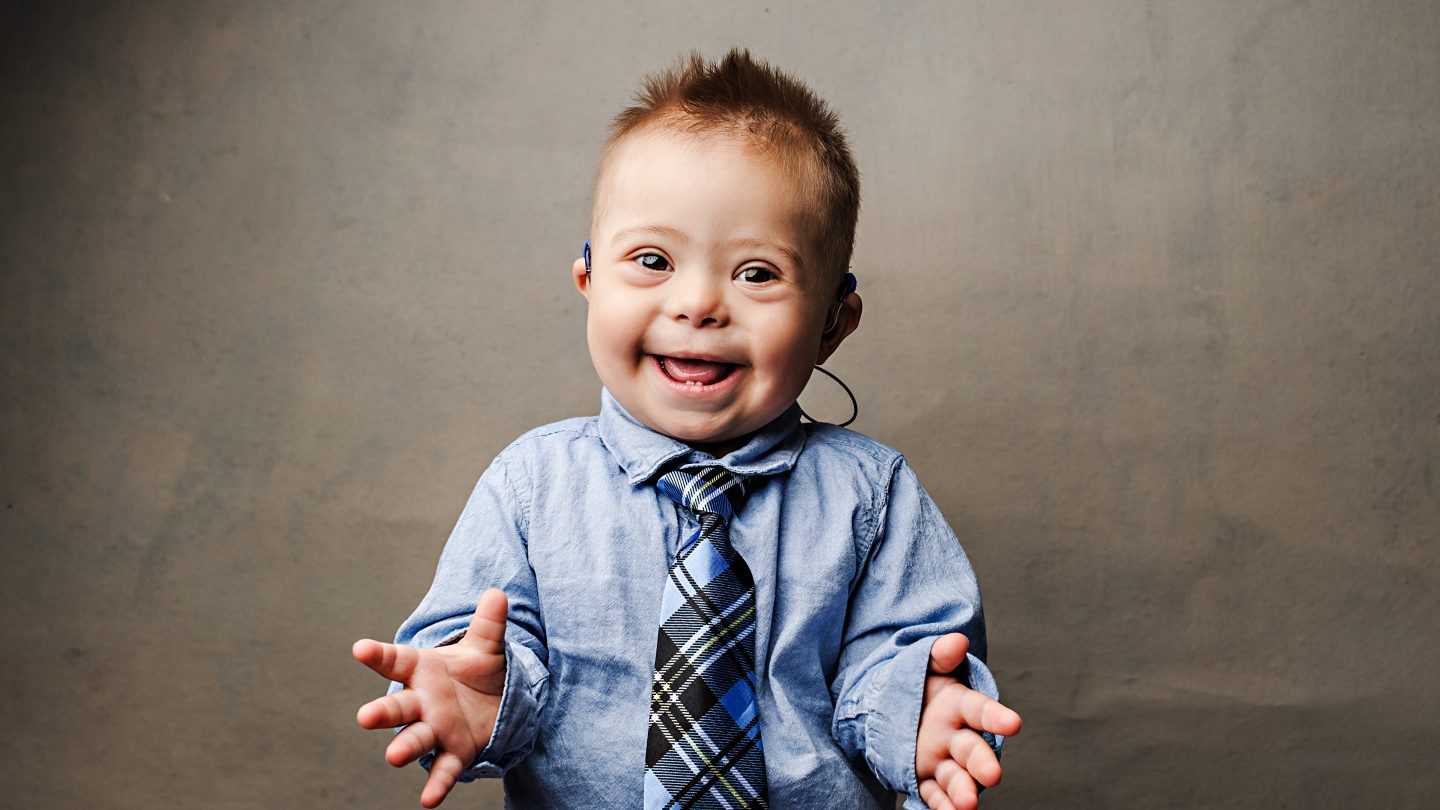Photo essay challenges Down syndrome stereotypes Broadview Magazine