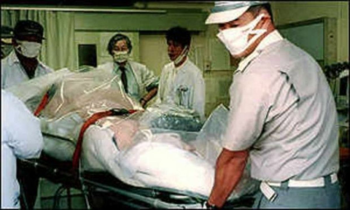 The Story Of Hisashi Ouchi A Man Who Experienced One Of The Most