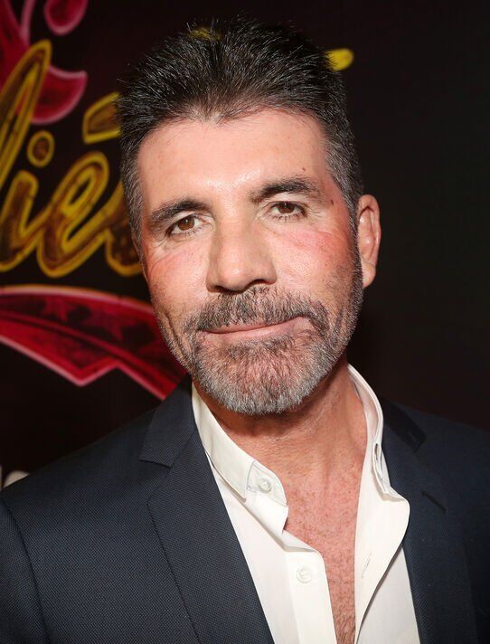 Simon Cowell's changing face defended by costar Amanda Holden Celebrity News & TV