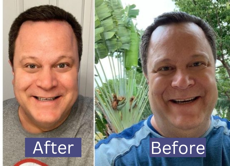 David Venable Weight Loss Surgery Diet Or Surgery? The Secrets Of QVC