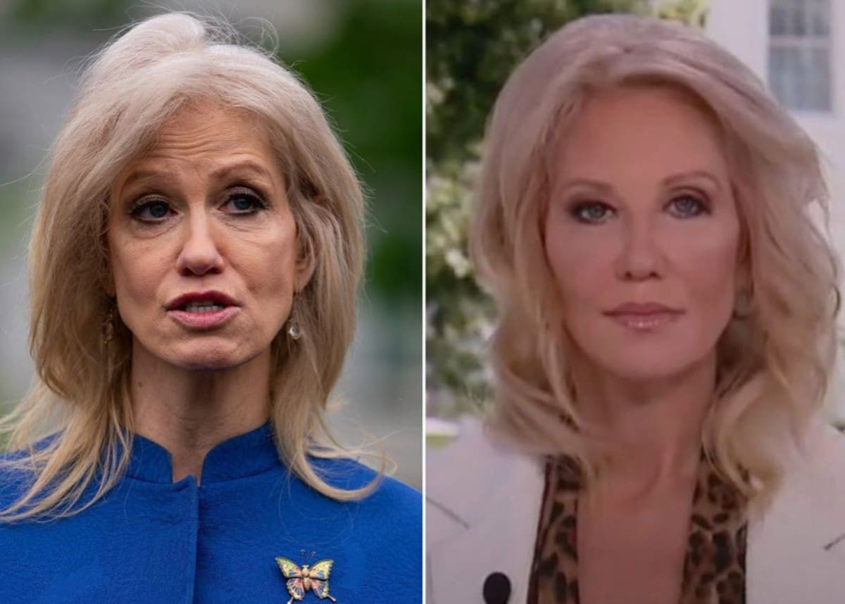 Kellyanne Conway Is After GlowUp — Did She Have Plastic