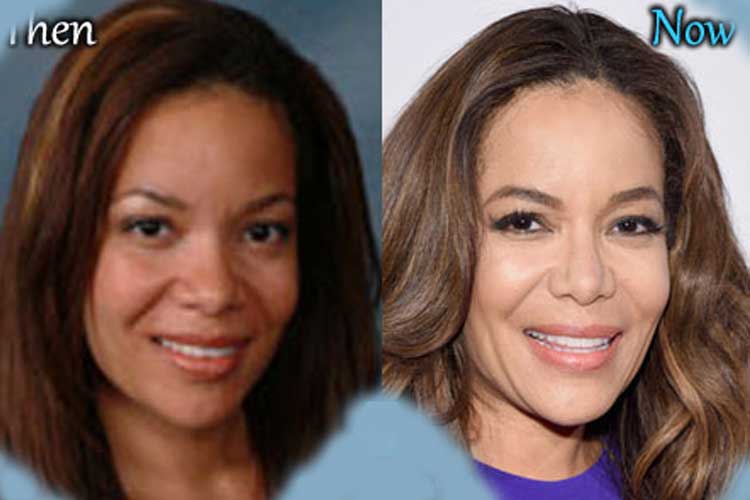 Sunny Hostin Plastic Surgery Nose Job, Botox, Facelift