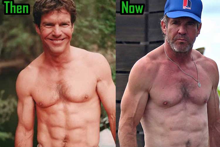 Dennis Quaid Plastic Surgery Botox, Eyelid Surgery, Before and After