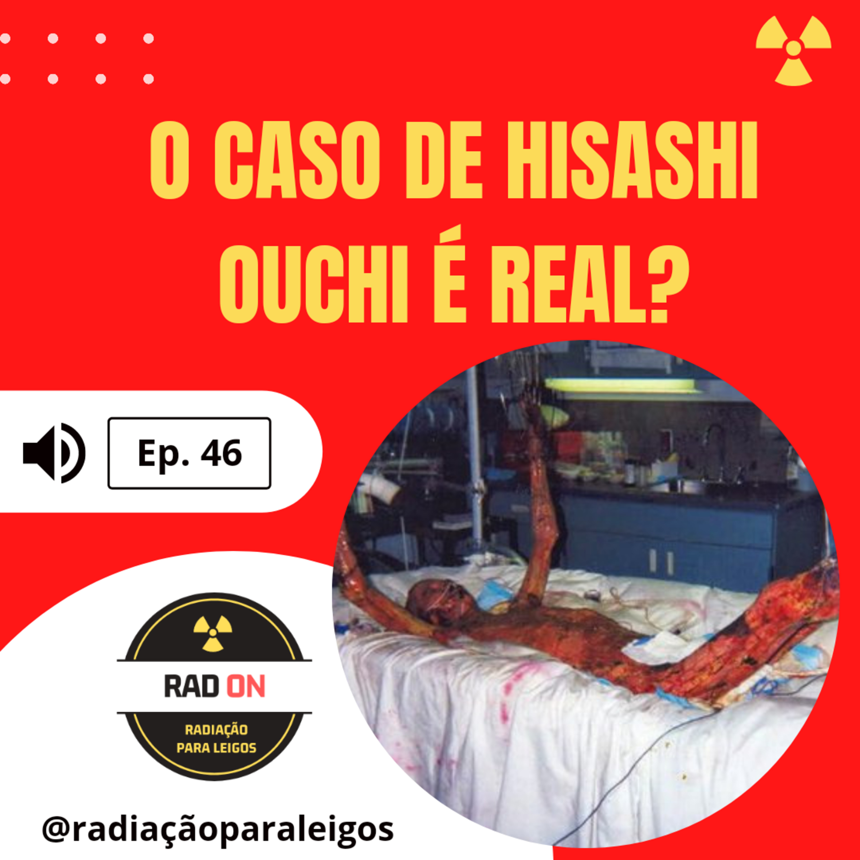 RadOn46 O caso de Hisashi Ouchi é real? Radiação para Leigos Podcast Podtail