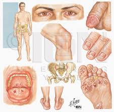 Std Symptoms Dr Sharmila Majumdar Sexologist Psychoanalyst