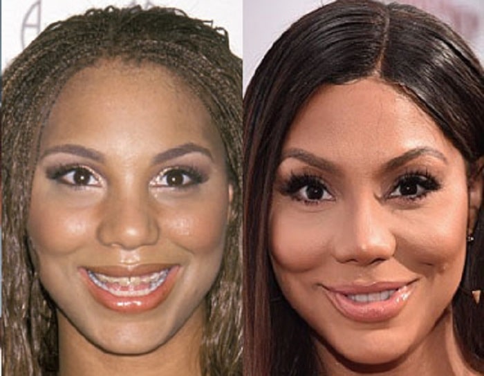 Tamar Braxton Plastic Surgeries and Tattoos Before and After Pictures