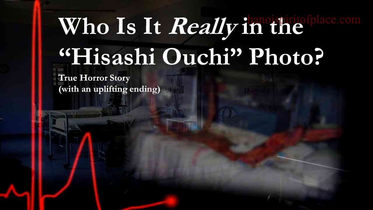 Hisashi Ouchi Real Photos Hospital Unveiling a Tragic Medical Case