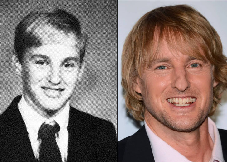 What Happened To Owen Wilson’s Nose? Here’s How It Looked Before