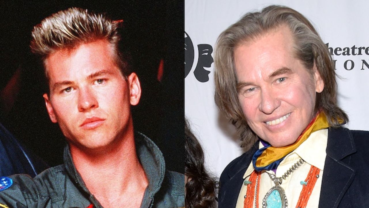 Val Kilmer’s Plastic Surgery Does He Look Young Even After His Health