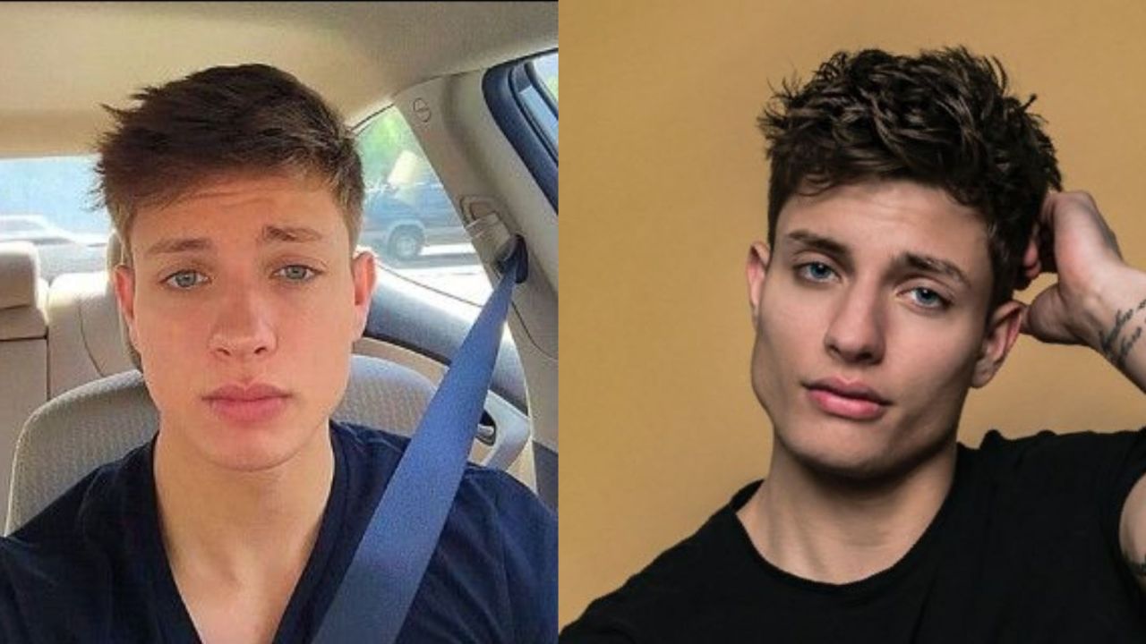 Matt Rife's Plastic Surgery Did The Comedian Have a GlowUp or Did He