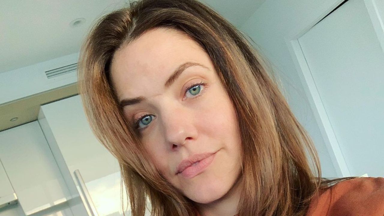 Julie Gonzalo’s Scar Birth Mark or What?