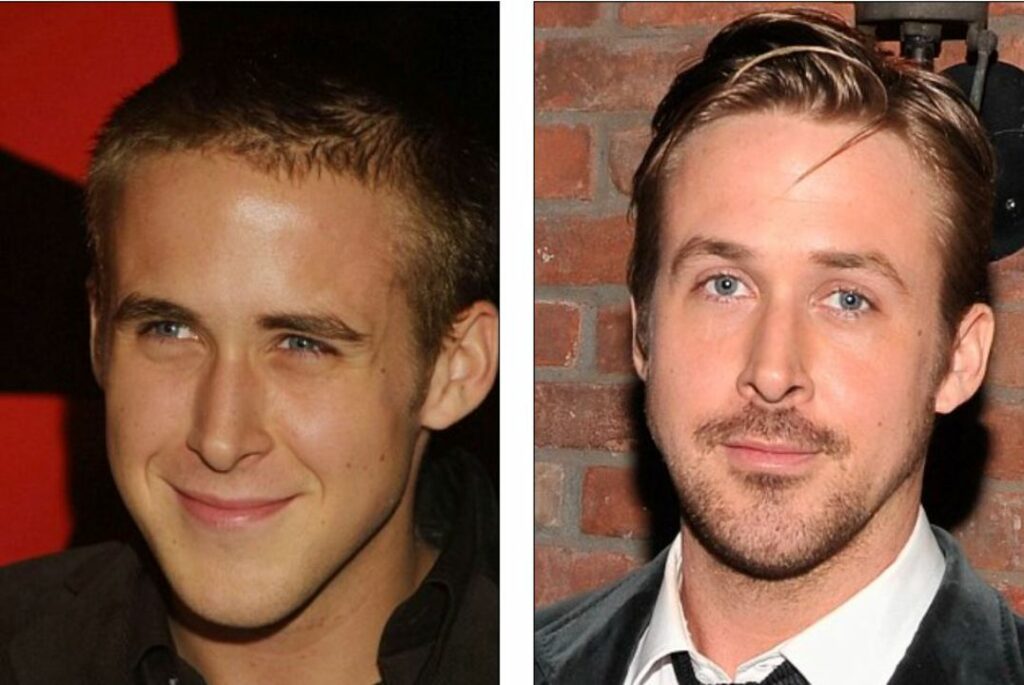 Has Ryan Gosling Received a Nose Job? Then and Now Pictures Examined!