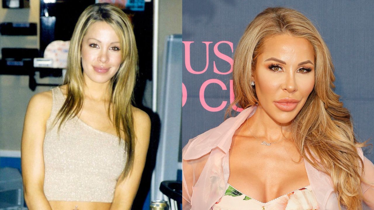 Lisa Hochstein Before and After Plastic Surgery Botox, Teeth Work