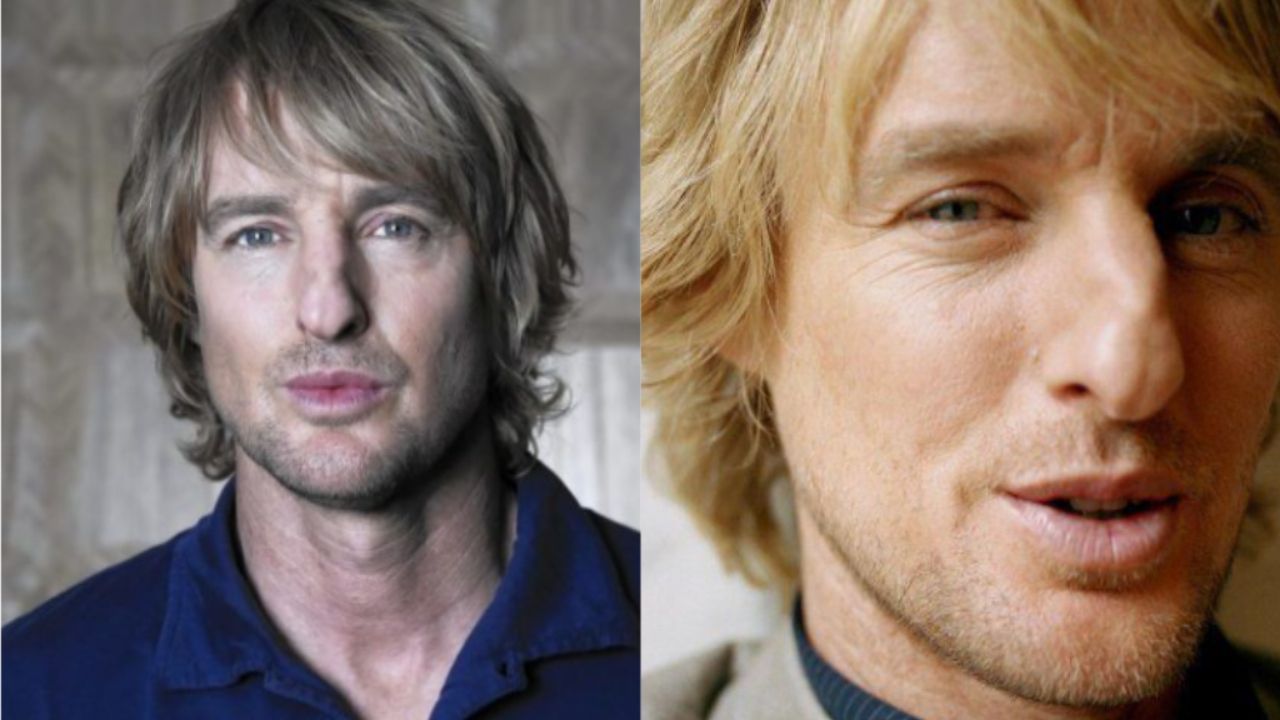 Owen Wilson's Plastic Surgery Marry Me Star Before and After Cosmetic