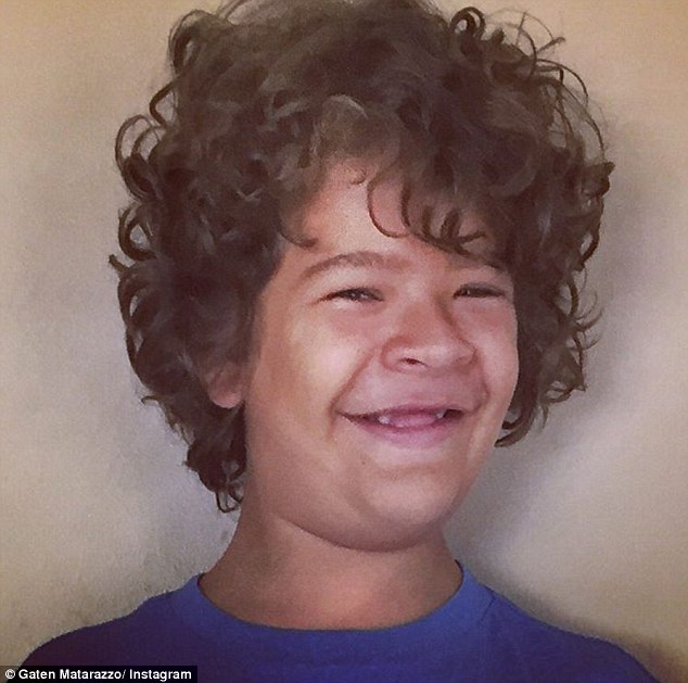 Stranger Things actor Gaten Matarazzo talks about Cleidocranial