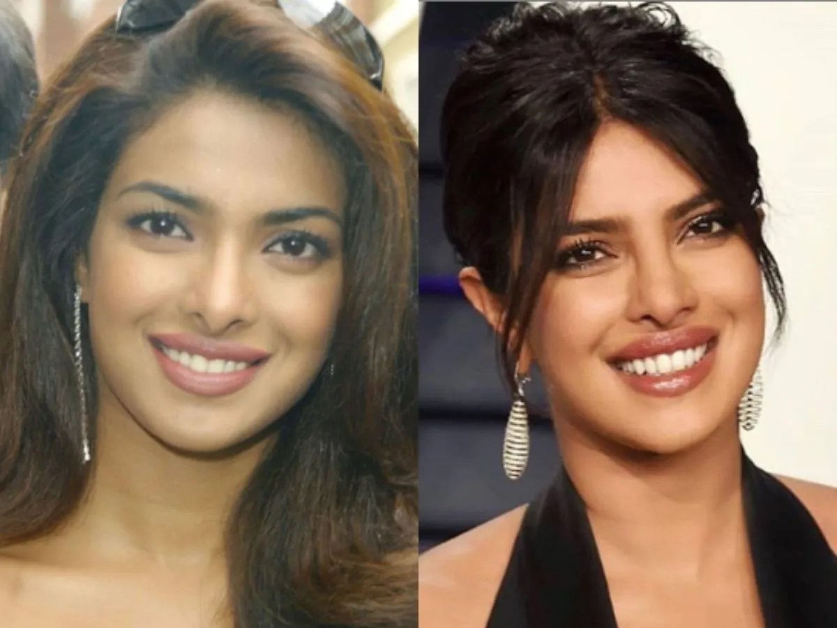 Priyanka Chopra beforeafter pics Transformation Tuesday Priyanka