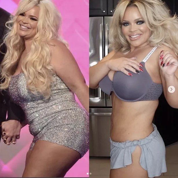 Trisha Paytas flaunts 3st weight loss as she reveals how she lost it in a year Daily Star