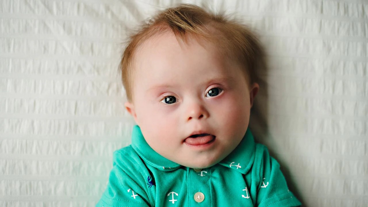 Four in five children with Down syndrome are born to mothers under the