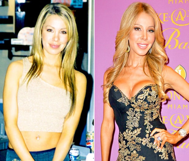 Lisa Hochstein Real Housewives' Plastic Surgery See Their Before and