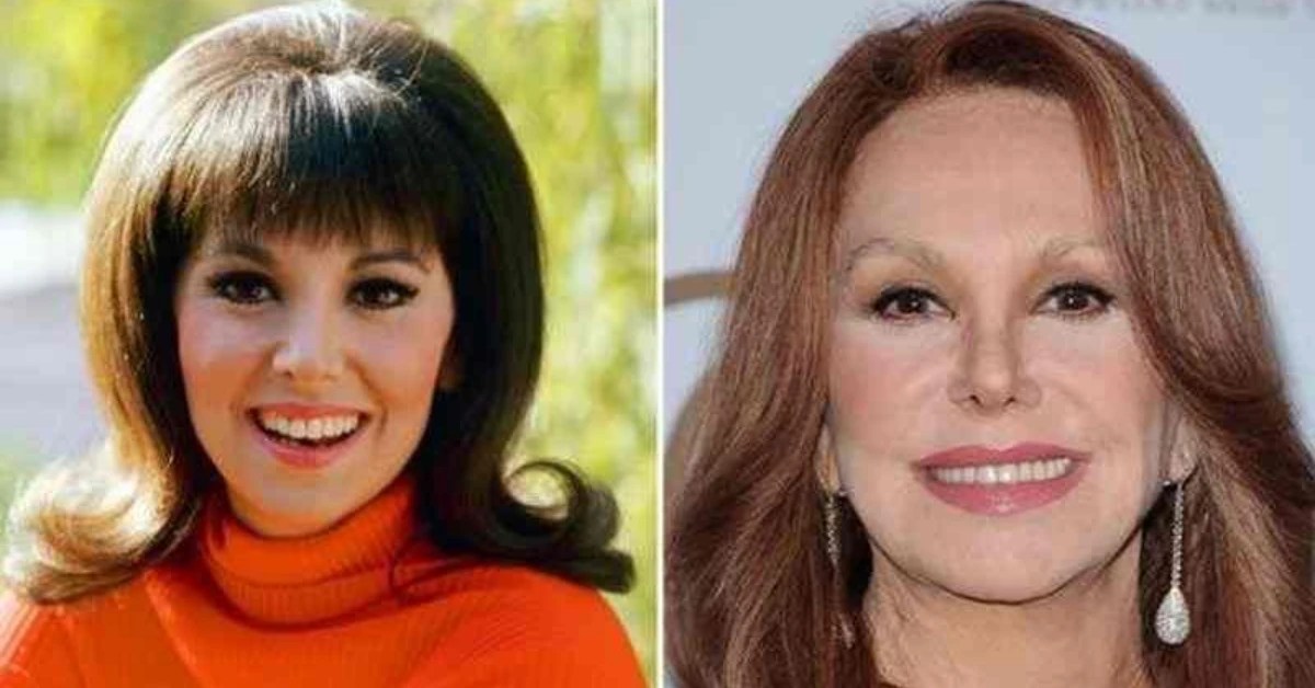 Marlo Thomas Plastic Surgery What Happened To Her Face?