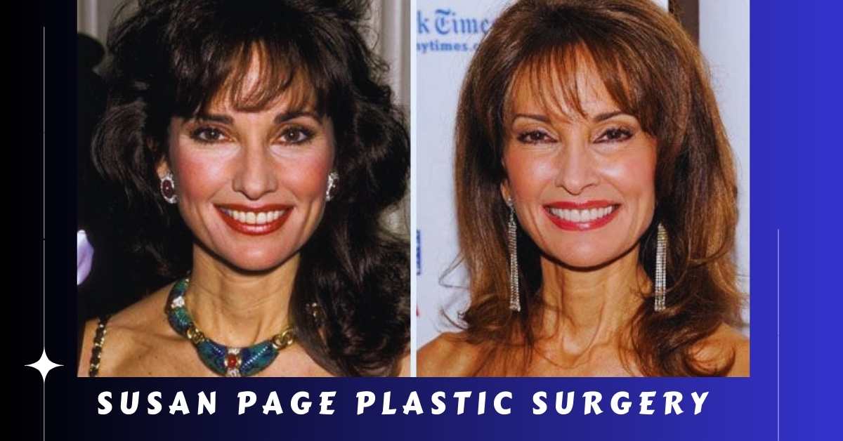 Susan Page Plastic Surgery A Journey Towards Renewed Confidence