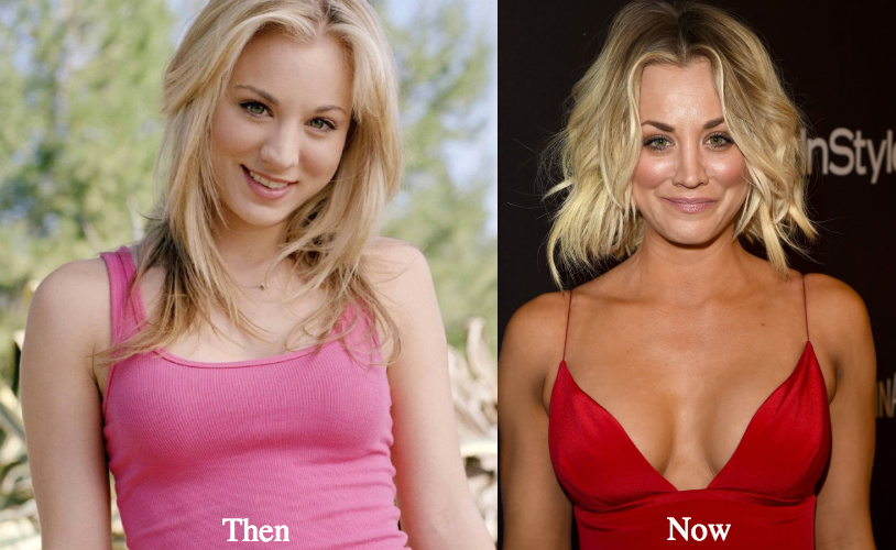 Kaley Cuoco Plastic Surgery Before and After Photos