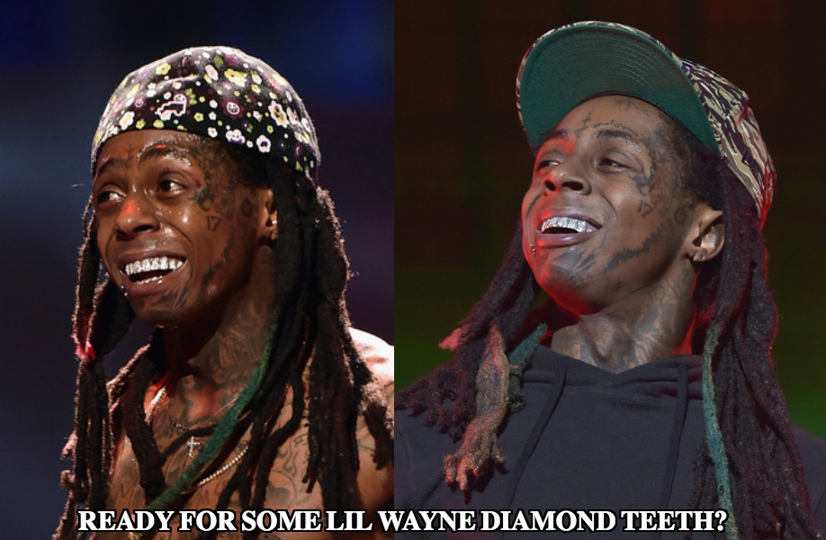 Lil Wayne Teeth Diamonds Make His Words Precious! Latest Plastic