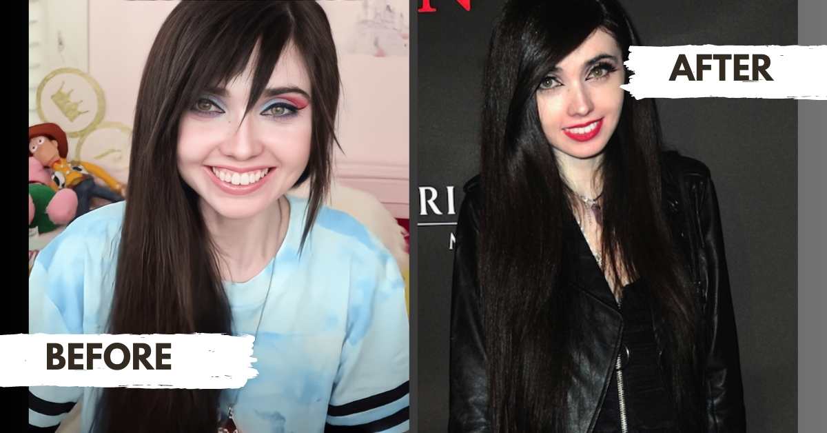 Eugenia Cooney Before And After What Really Happened To Her?