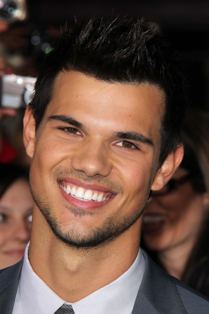 Celebrities you never noticed have lazy eyes