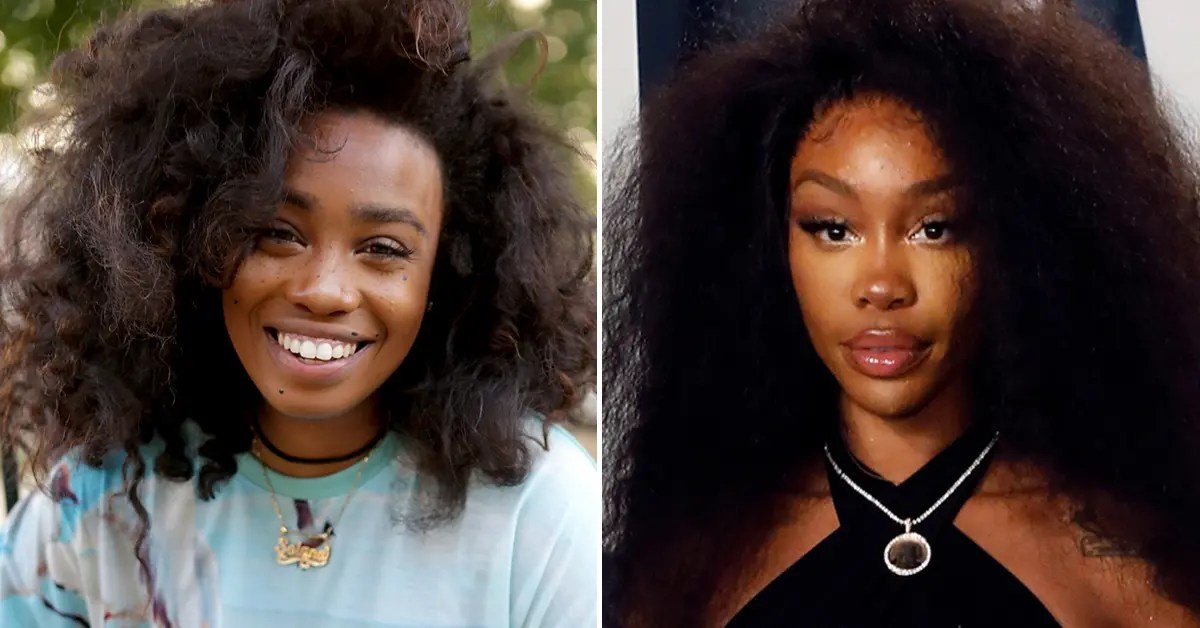 SZA Before Surgery See the Singer's Drastic Transformation