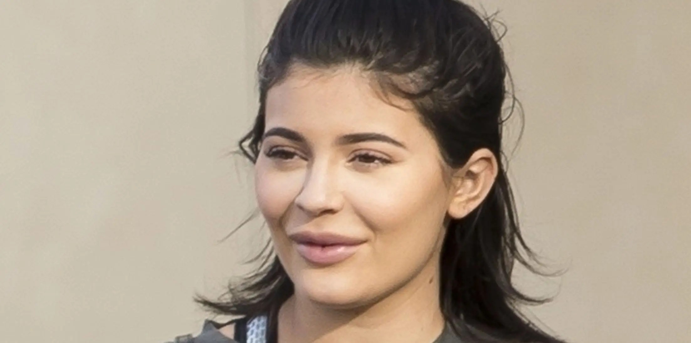 Kylie Jenner's Lip Injections May Have Gone Overboard
