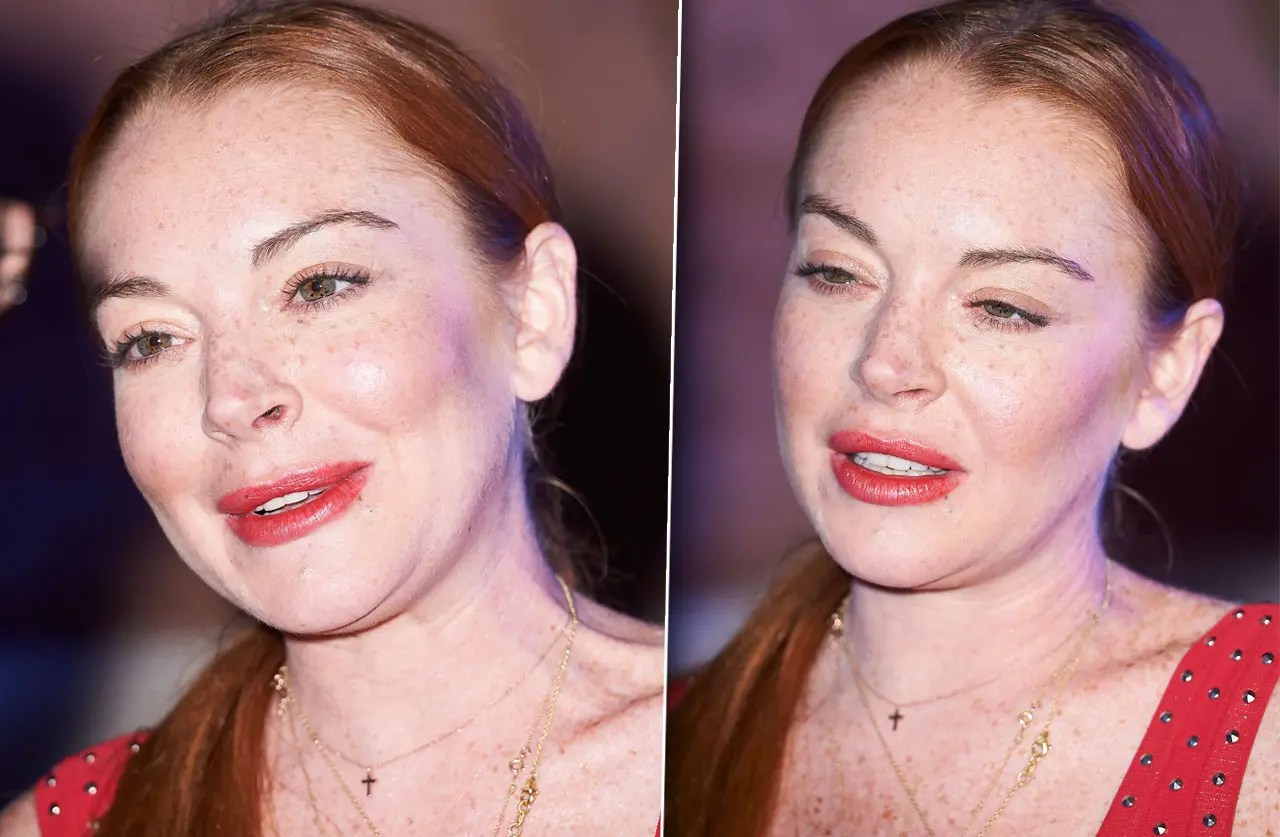 Lindsay Lohan's Face Looks Bizarre Amid Plastic Surgery Rumors