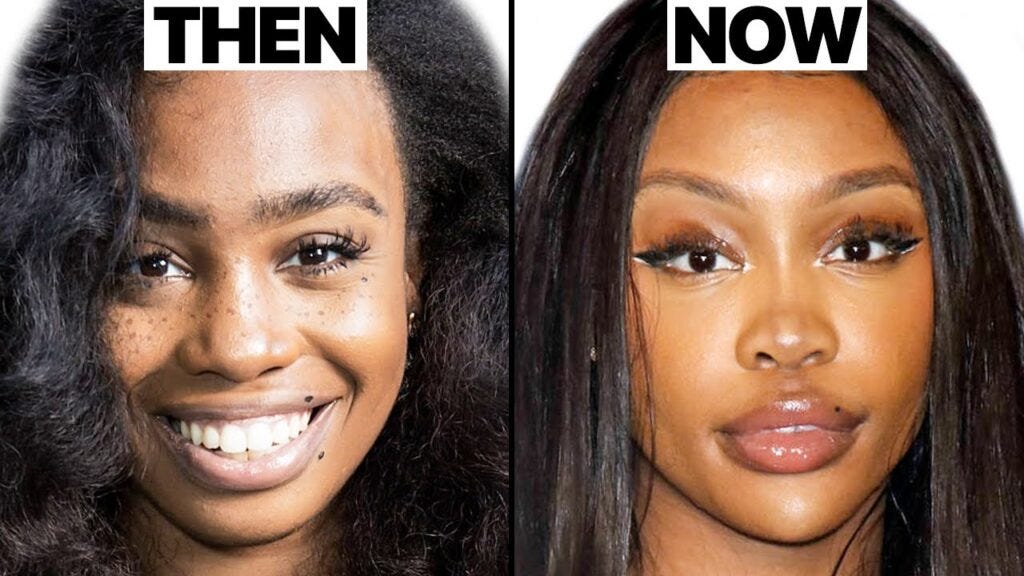 SZA Before Plastic Surgery. Introduction by Surgical Tech Medium