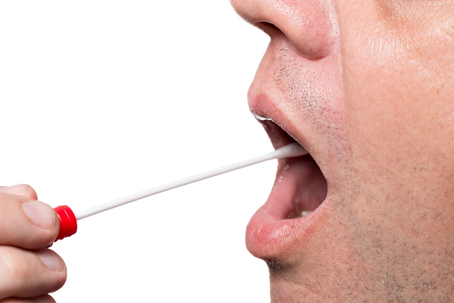 Factors That Can Affect the Cost of DNA Testing