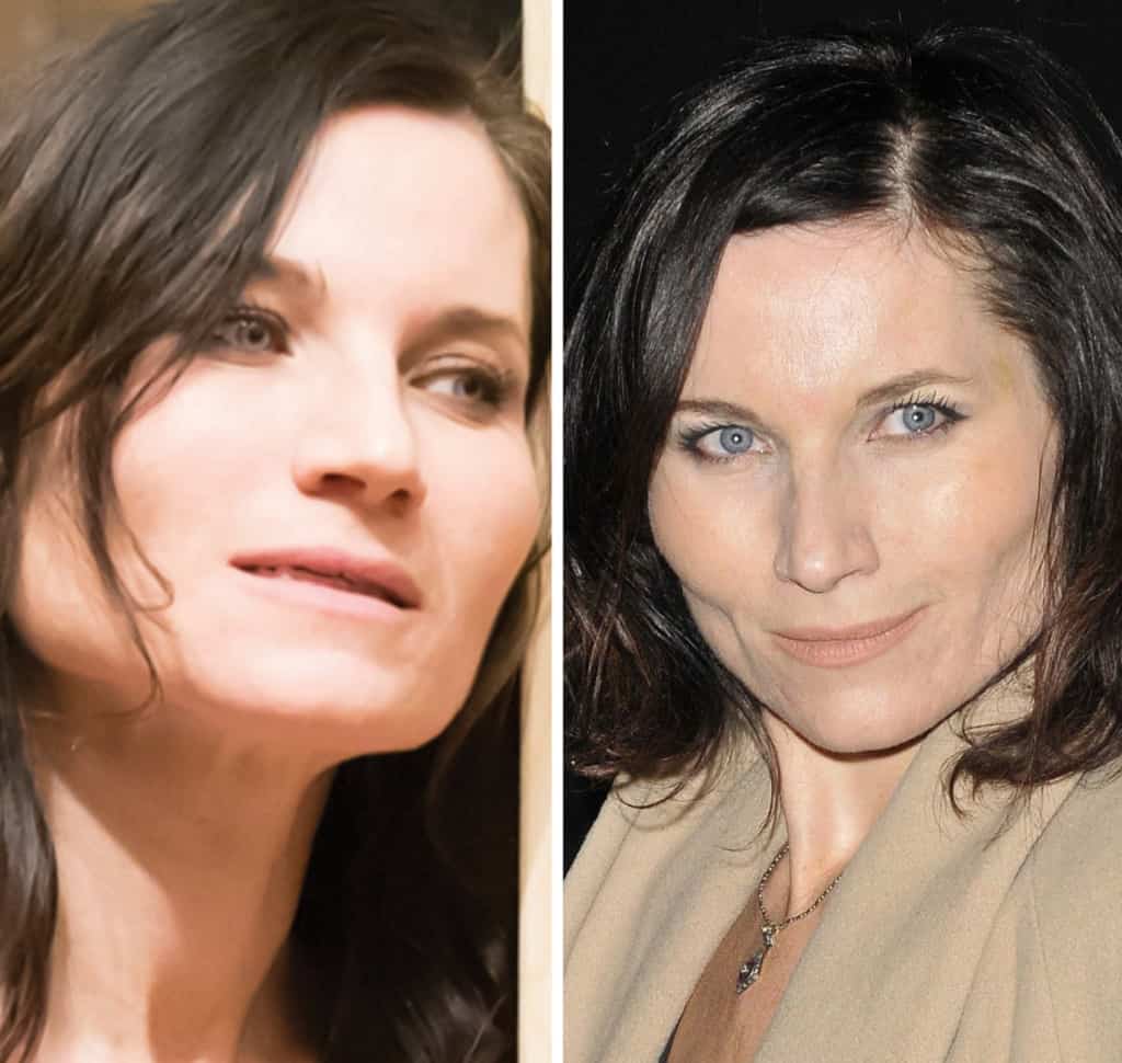 Kate Fleetwood Plastic Surgery How Is Her Jaw Line?