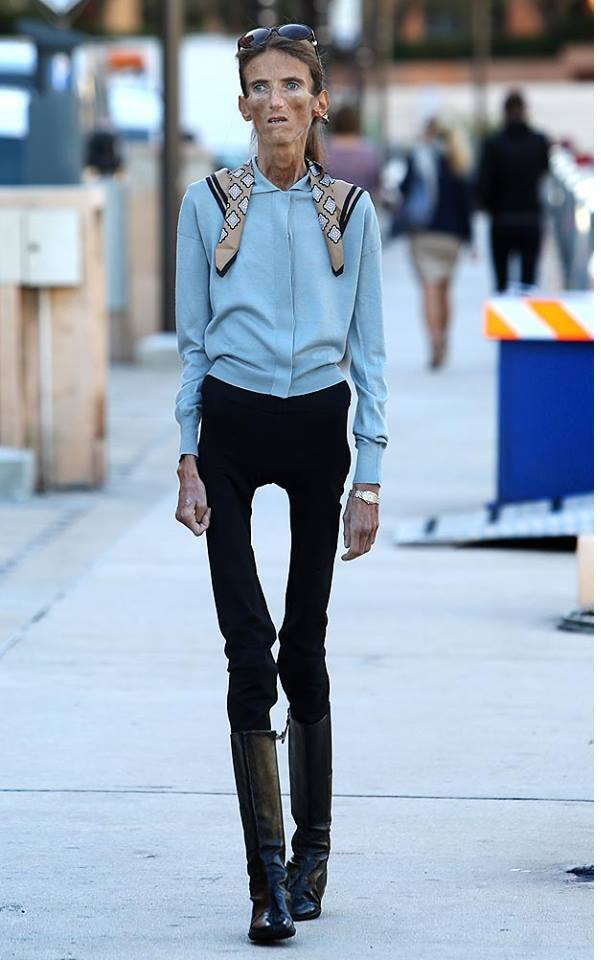 9 skinniest people in the world Tuko.co.ke