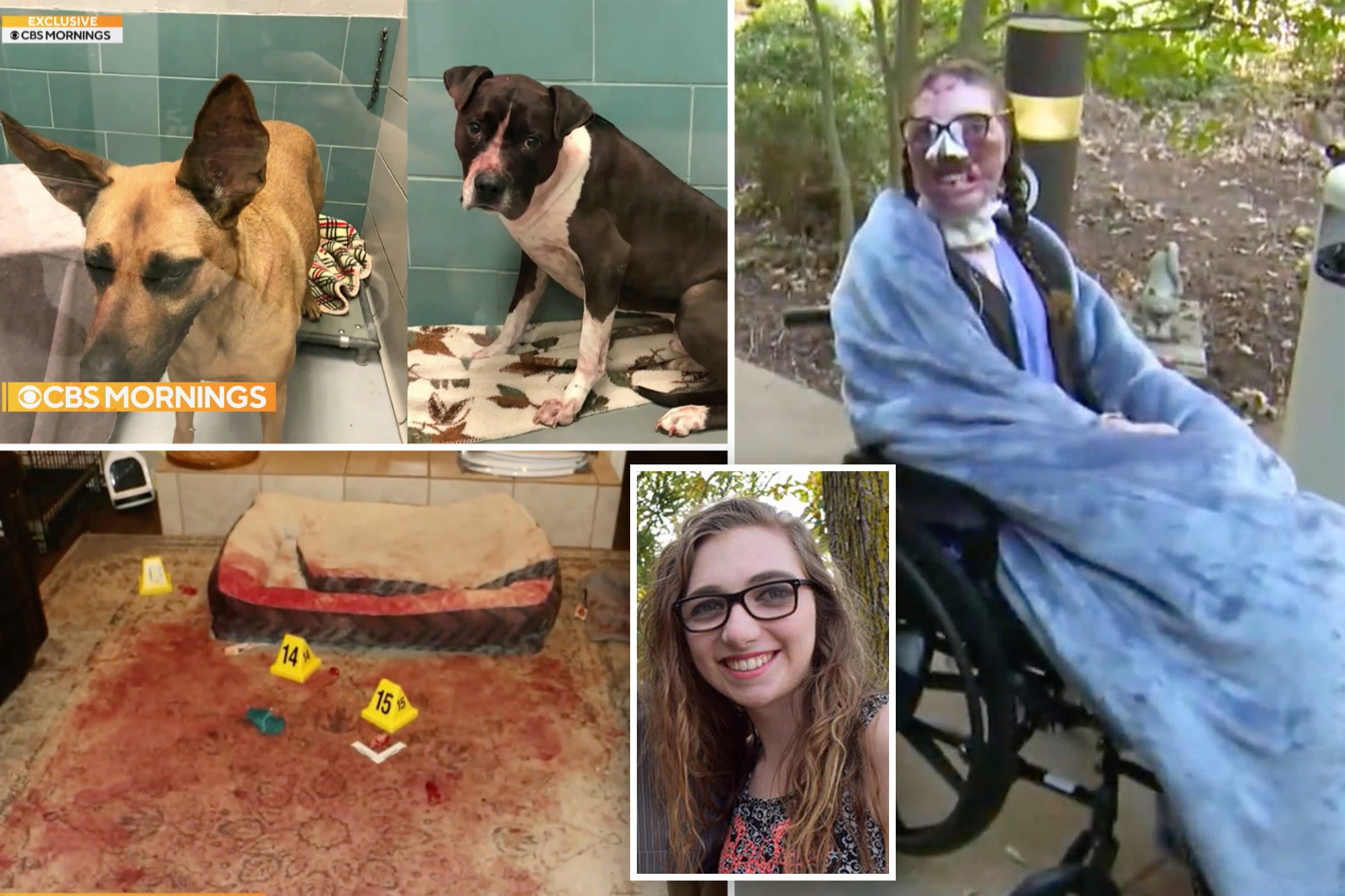 College student who was disfigured in vicious attack by dogs reveals