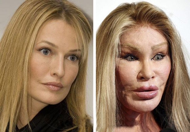 Jocelyn Wildenstein Botched Surgery Photos