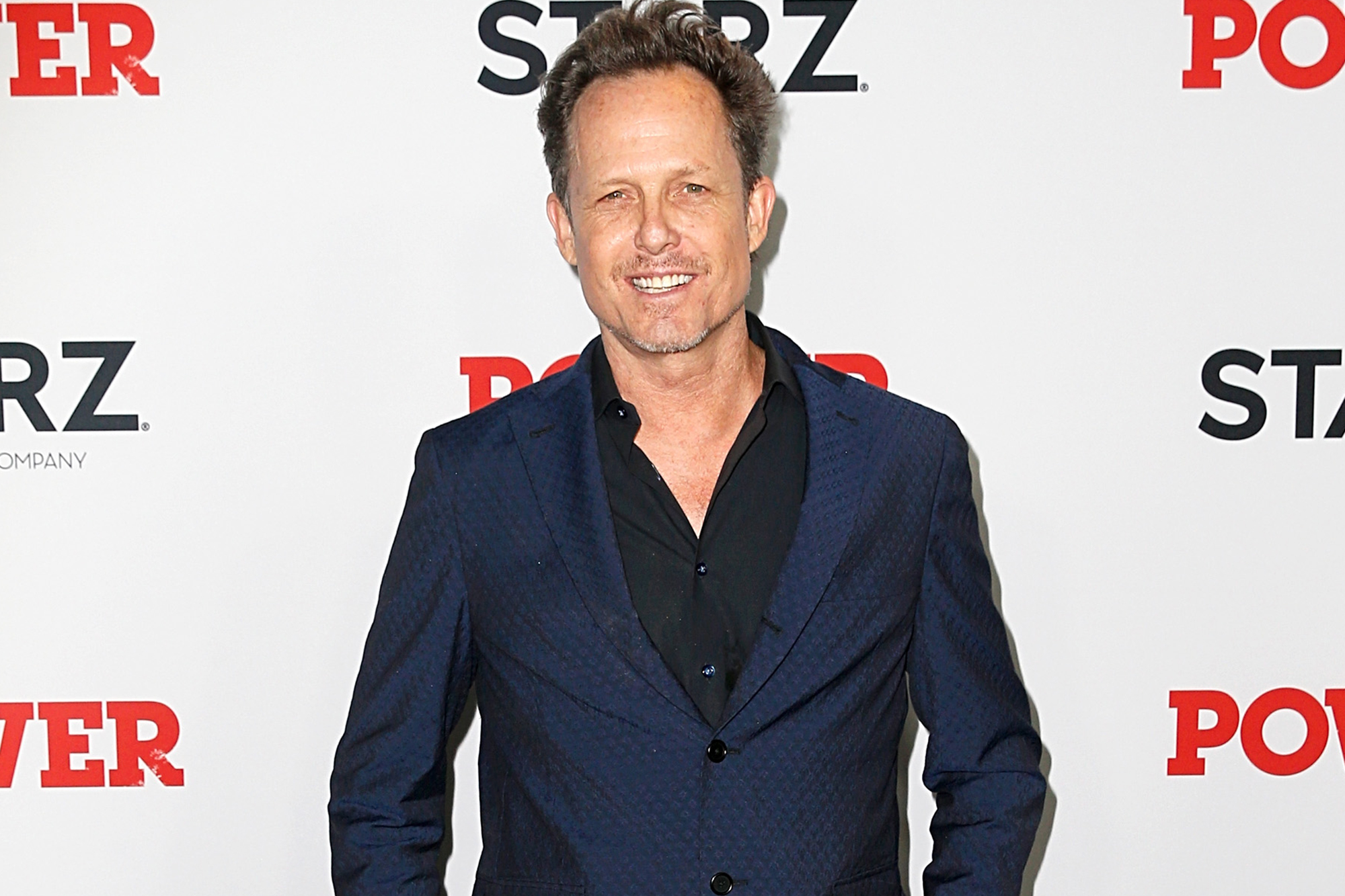 Dean Winters in constant pain from multiple amputations