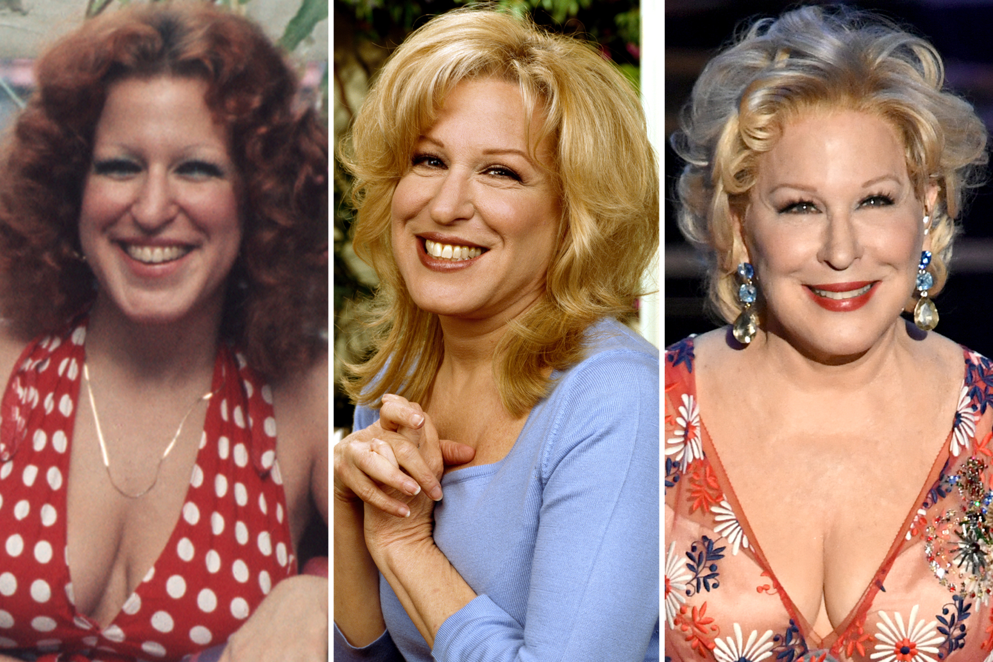Bette Midler, 77, admits to getting plastic surgery on her face