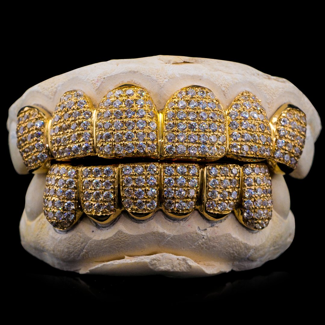 gold grills