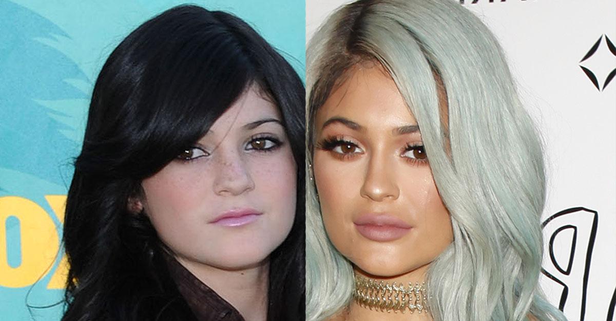 Kylie Jenner Plastic Surgery Before And After The Biggest Changes In