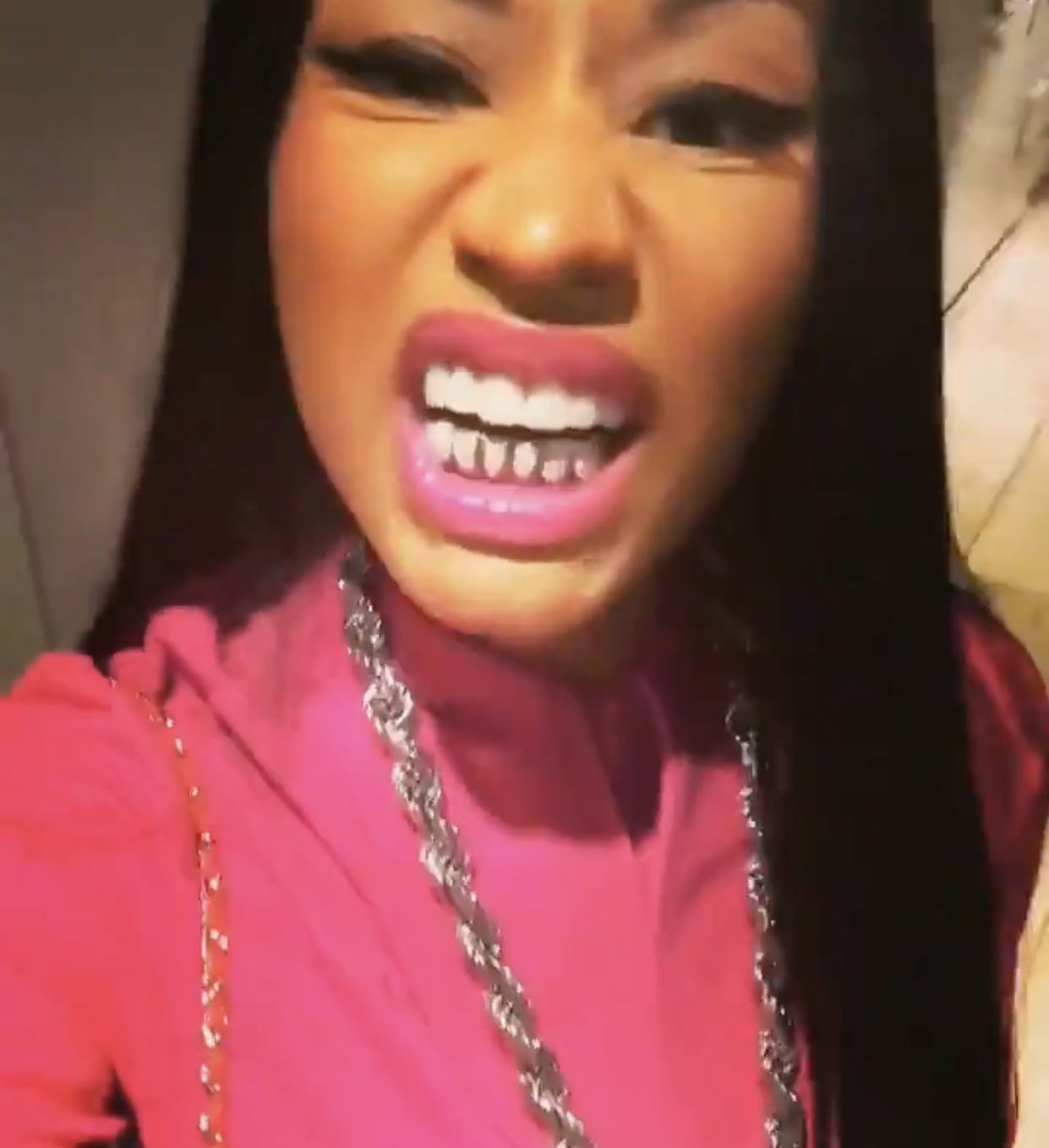 Nicki Minaj Without Teeth