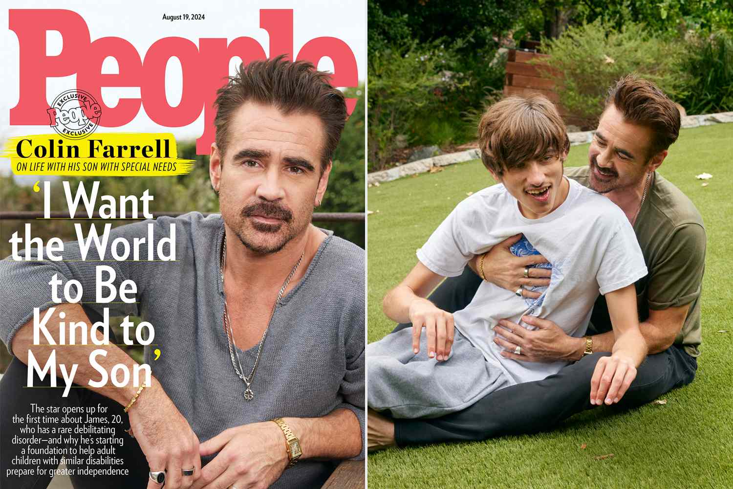 Colin Farrell Recalls Painful Question He Asked Doctor After Son’s