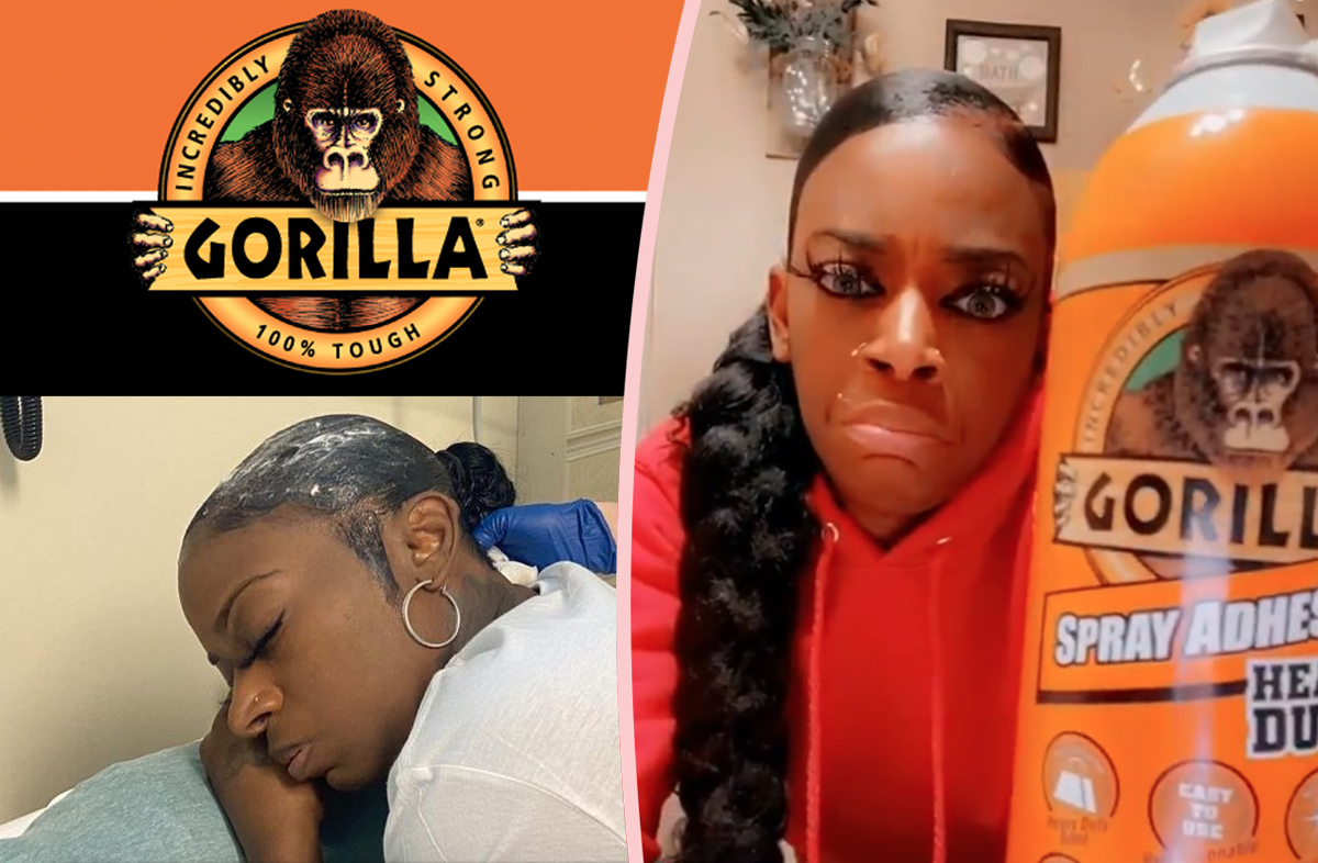 'It Started To Burn' Gorilla Glue Girl Tells Full Horror Story In